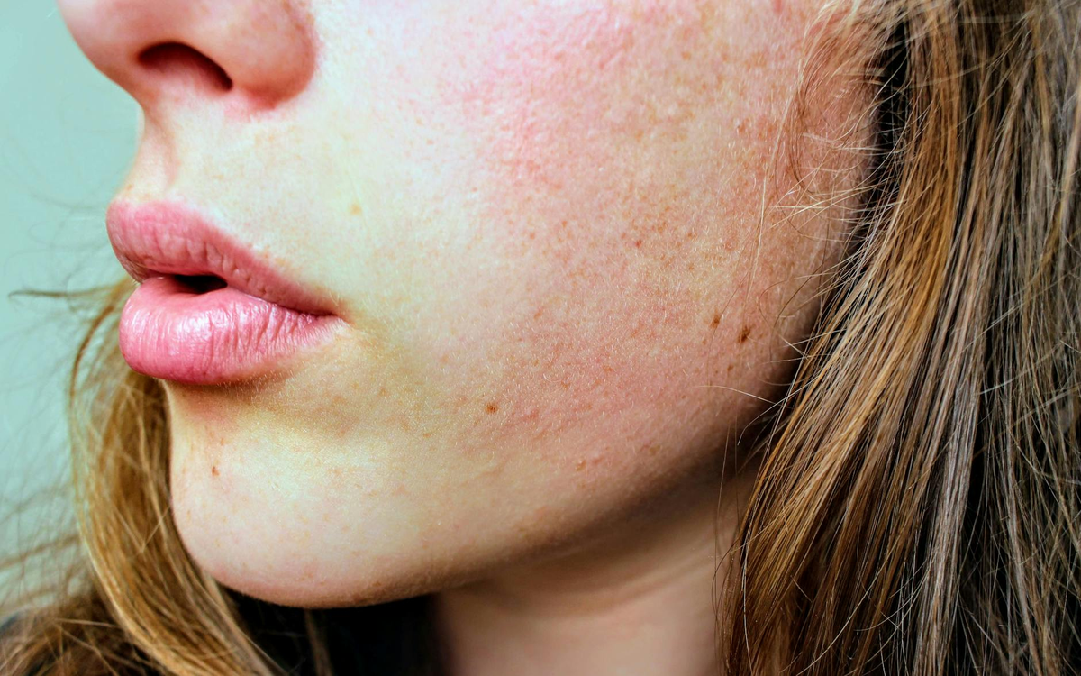 A close-up on radiant, flawless human skin, subtly illuminated by a high-tech holographic overlay displaying a perfectly balanced and thriving ecosystem of beneficial skin microorganisms, embodying a biohacker's precise control.