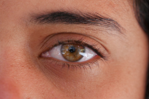 Close-up of a human eye featuring a detailed hazel iris, dark lashes, and visible sclera, representing the focus on ocular health and advanced procedures for severe dry eye conditions.