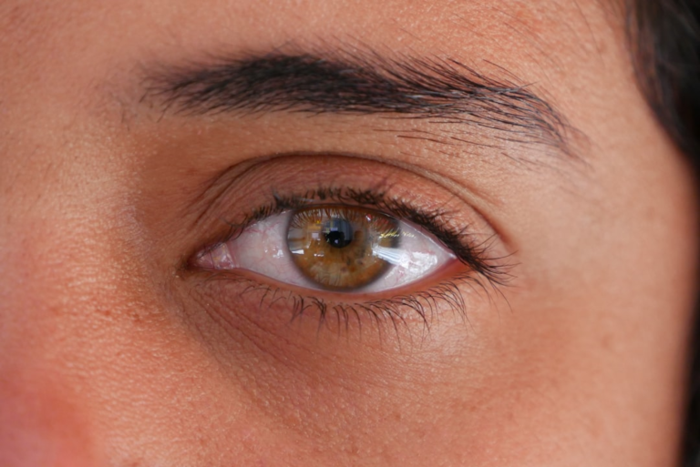 Close-up of a human eye featuring a detailed hazel iris, dark lashes, and visible sclera, representing the focus on ocular health and advanced procedures for severe dry eye conditions.