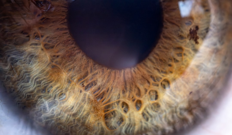 Extreme close-up of a detailed hazel human eye, highlighting the intricate patterns of the iris and a dark pupil, relevant for understanding chronic dry eye conditions and treatments.