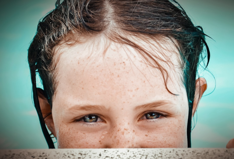 Close-up of a young person's luminous blue-green eyes, adorned with water droplets and freckles, gazing intently, embodying the promise of light therapy for enhanced vision.